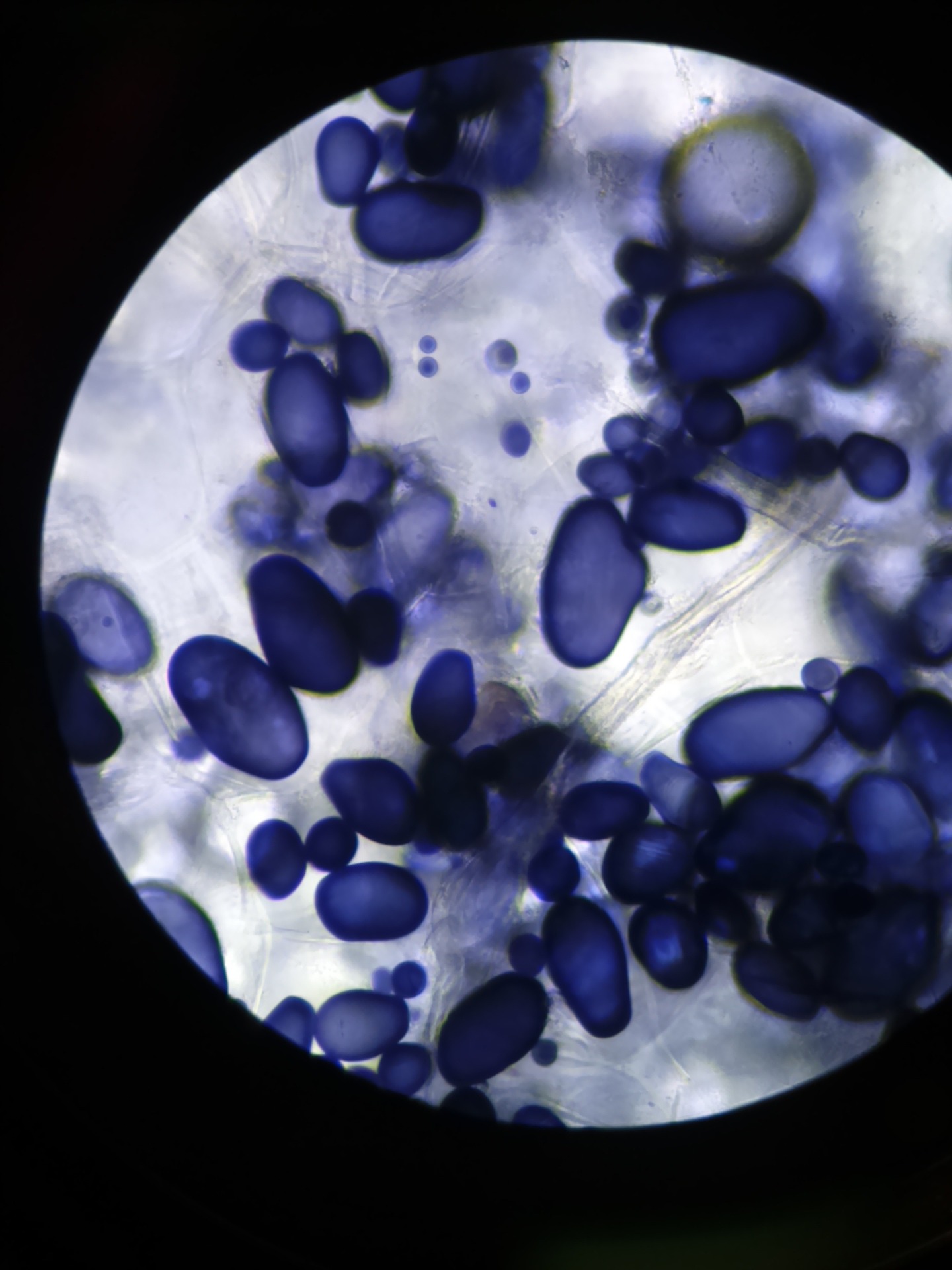 Amyloplasten und Stärkespeicherung in Pflanzen